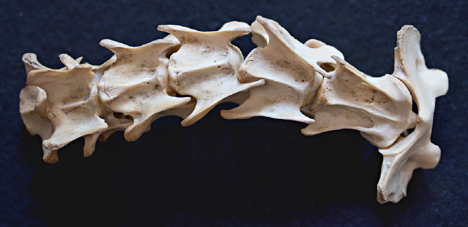 human vertebrae