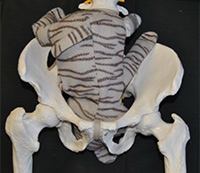 baby 2 in pelvis