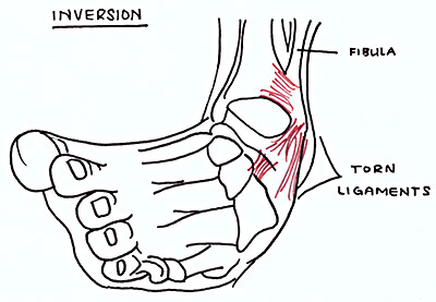 ankle inversion