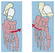 low ankle sprain