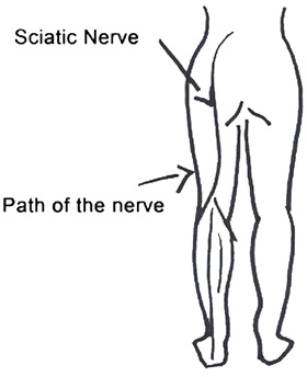 sciatic nerve diagram