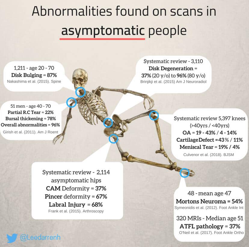 x-rays and MRIs and other scans very often do not tell you anything about your pain